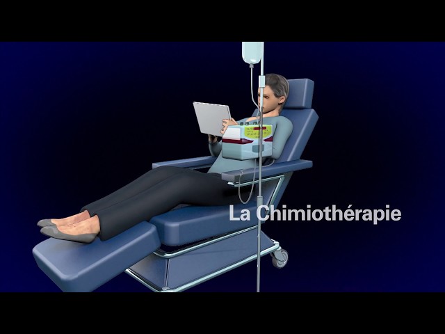 Chimiothérapie et radiothérapie : comprendre ces traitements et organiser ses déplacements médicaux